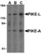 ArfGAP With GTPase Domain, Ankyrin Repeat And PH Domain 2 antibody, MBS150273, MyBioSource, Western Blot image 