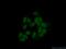 Heterogeneous nuclear ribonucleoprotein H antibody, 14774-1-AP, Proteintech Group, Immunofluorescence image 
