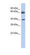 Chimerin 2 antibody, NBP1-55257, Novus Biologicals, Western Blot image 