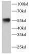 ETV6 antibody, FNab02882, FineTest, Western Blot image 