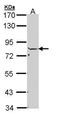 N-Ethylmaleimide Sensitive Factor, Vesicle Fusing ATPase antibody, GTX110275, GeneTex, Western Blot image 