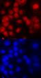 DNA Methyltransferase 3 Alpha antibody, MAB6315, R&D Systems, Immunofluorescence image 