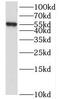 Leukocyte Receptor Cluster Member 9 antibody, FNab04749, FineTest, Western Blot image 