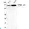 ERCC Excision Repair 3, TFIIH Core Complex Helicase Subunit antibody, LS-C814134, Lifespan Biosciences, Western Blot image 