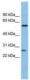 Chymotrypsinogen B1 antibody, TA334292, Origene, Western Blot image 