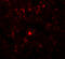 Rhomboid domain-containing protein 2 antibody, A13726, Boster Biological Technology, Immunofluorescence image 