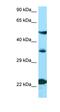 Melanocortin 4 Receptor antibody, orb331217, Biorbyt, Western Blot image 
