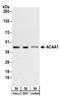 3-ketoacyl-CoA thiolase, peroxisomal antibody, A304-285A, Bethyl Labs, Western Blot image 