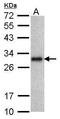Protein lin-28 homolog A antibody, GTX628138, GeneTex, Western Blot image 