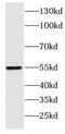 Docking Protein 2 antibody, FNab02501, FineTest, Western Blot image 