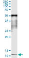 Serum Amyloid A4, Constitutive antibody, LS-C198147, Lifespan Biosciences, Immunoprecipitation image 