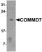 NADH:Ubiquinone Oxidoreductase Subunit A10 antibody, orb73555, Biorbyt, Western Blot image 