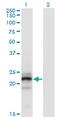 Human Chorionic gonadotrophin antibody, LS-C196902, Lifespan Biosciences, Western Blot image 