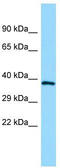 GP160 antibody, TA331206, Origene, Western Blot image 