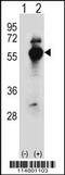 Aspartyl-TRNA Synthetase antibody, 55-617, ProSci, Western Blot image 