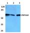 Zinc Finger Protein 460 antibody, A14143-1, Boster Biological Technology, Western Blot image 