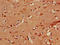 PLXND1 antibody, LS-C679077, Lifespan Biosciences, Immunohistochemistry paraffin image 