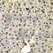 SSX Family Member 5 antibody, A7732, ABclonal Technology, Immunohistochemistry paraffin image 