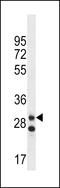Leucine Rich Repeat Containing 3C antibody, 60-220, ProSci, Western Blot image 