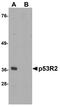 Ribonucleotide Reductase Regulatory TP53 Inducible Subunit M2B antibody, NBP1-76781, Novus Biologicals, Western Blot image 