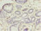 Ubiquitin Conjugating Enzyme E2 D1 antibody, A50580-100, Epigentek, Immunohistochemistry paraffin image 