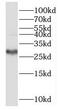Family With Sequence Similarity 192 Member A antibody, FNab05735, FineTest, Western Blot image 