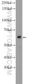 PARN Like, Ribonuclease Domain Containing 1 antibody, 25559-1-AP, Proteintech Group, Western Blot image 