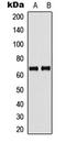 Guanylate Binding Protein 5 antibody, LS-C358989, Lifespan Biosciences, Western Blot image 