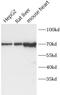 Carnitine O-palmitoyltransferase 2, mitochondrial antibody, FNab10374, FineTest, Western Blot image 
