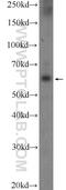 POTE Ankyrin Domain Family Member H antibody, 24837-1-AP, Proteintech Group, Western Blot image 