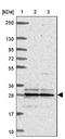 Mitochondrial Ribosomal Protein L16 antibody, NBP2-49119, Novus Biologicals, Western Blot image 