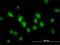 SMAD Family Member 1 antibody, H00004086-M03, Novus Biologicals, Immunocytochemistry image 