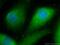 DnaJ homolog subfamily B member 13 antibody, 25118-1-AP, Proteintech Group, Immunofluorescence image 