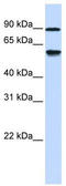 Alcohol Dehydrogenase Iron Containing 1 antibody, TA340347, Origene, Western Blot image 