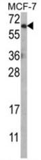 Protein kinase B antibody, AP17878PU-N, Origene, Western Blot image 