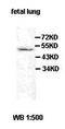 ATP Binding Cassette Subfamily C Member 1 antibody, orb77470, Biorbyt, Western Blot image 