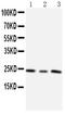 TIMP Metallopeptidase Inhibitor 4 antibody, LS-C343864, Lifespan Biosciences, Western Blot image 