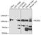 Procollagen-lysine,2-oxoglutarate 5-dioxygenase 1 antibody, GTX32707, GeneTex, Western Blot image 