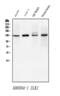 Unc-51 Like Autophagy Activating Kinase 1 antibody, A00584-1, Boster Biological Technology, Western Blot image 