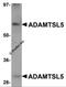 ADAMTS Like 5 antibody, 5687, ProSci, Western Blot image 