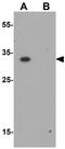 Rab-interacting lysosomal protein antibody, GTX32069, GeneTex, Western Blot image 