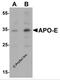 Apolipoprotein E antibody, 7333, ProSci Inc, Western Blot image 