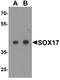 SRY-Box 17 antibody, A01665, Boster Biological Technology, Western Blot image 