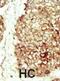 Fibroblast growth factor receptor 2 antibody, abx033559, Abbexa, Immunocytochemistry image 