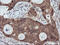 Ras association domain-containing protein 8 antibody, M11627-1, Boster Biological Technology, Immunohistochemistry paraffin image 