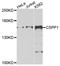Centrosome and spindle pole-associated protein 1 antibody, A07521, Boster Biological Technology, Western Blot image 