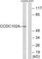 Coiled-Coil Domain Containing 102A antibody, abx014378, Abbexa, Western Blot image 