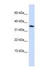 Homeobox protein EMX1 antibody, NBP1-79221, Novus Biologicals, Western Blot image 