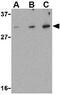 DNA damage-regulated autophagy modulator protein 1 antibody, GTX85483, GeneTex, Western Blot image 
