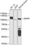 Amphiphysin antibody, A02364, Boster Biological Technology, Western Blot image 